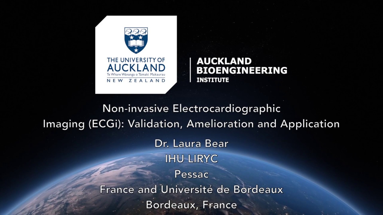 Non-invasive Electrocardiographic Imaging (ECGi): Validation, Amelioration and Application