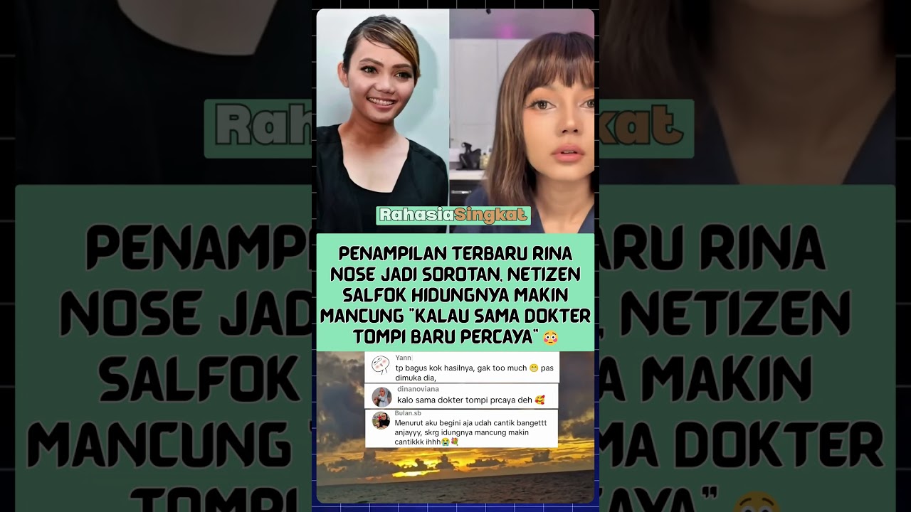 Penampilan Terbaru Rina Nose Bikin Netizen Salfok! 😳 | SelebGosip