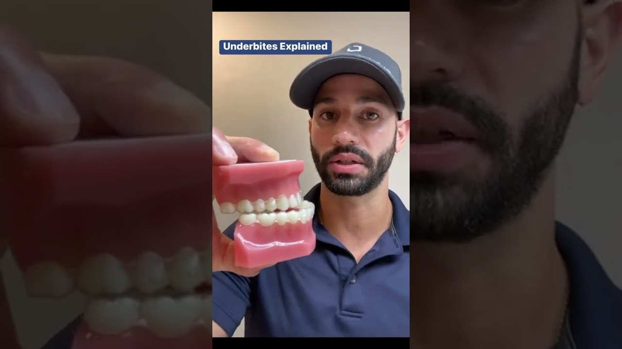 Underbites, Rubber Bands and Jaw Surgery