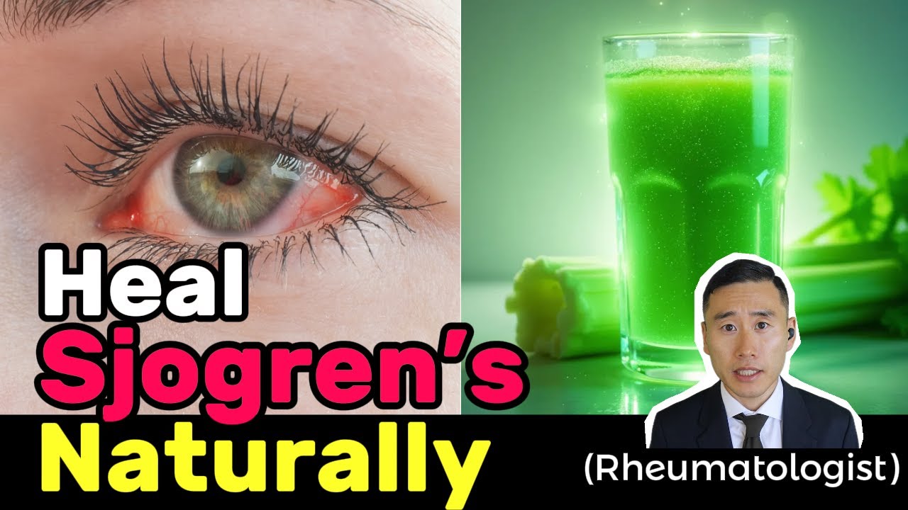 Must-Know Tips to Heal Sjogren&rsquo;s Naturally from an Integrative Rheumatologist