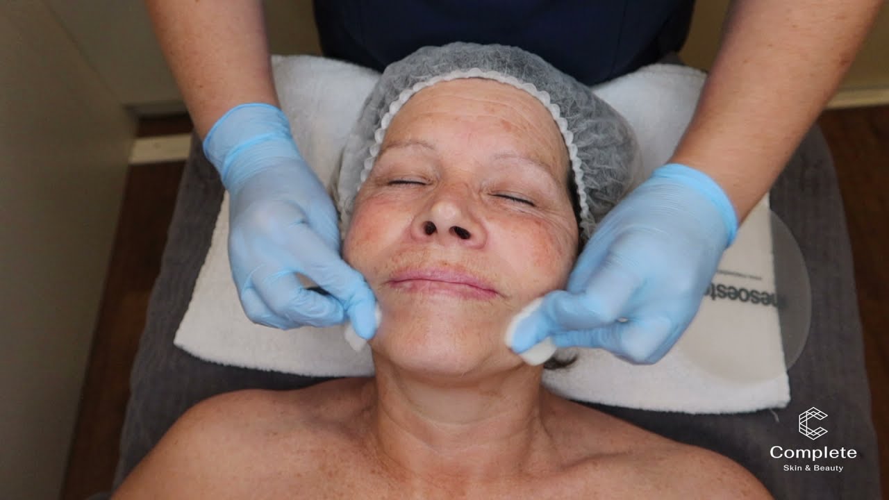 Mesoéclat Intensive Anti-ageing Facial at Complete Skin & Beauty