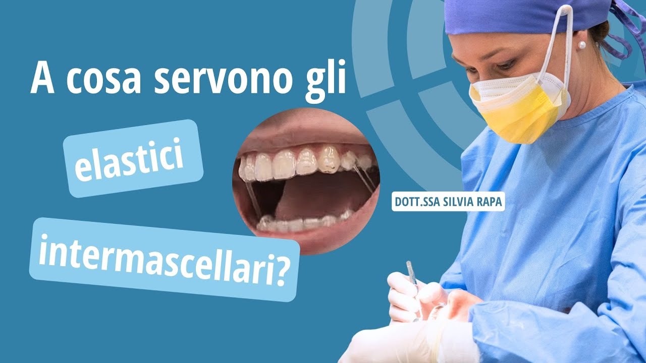 A cosa servono gli elastici intermascellari - Studio Ortodontico Cocconi Rapa