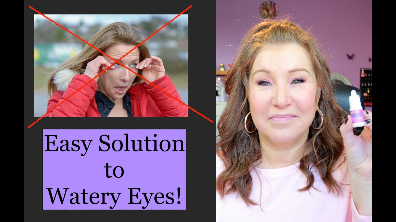 How To Get Rid Of Watery Eyes!