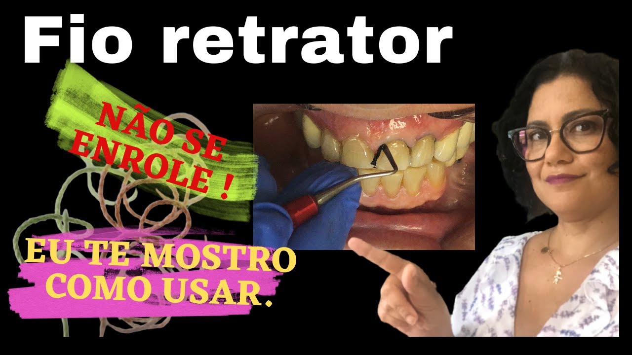 Fio Retrator