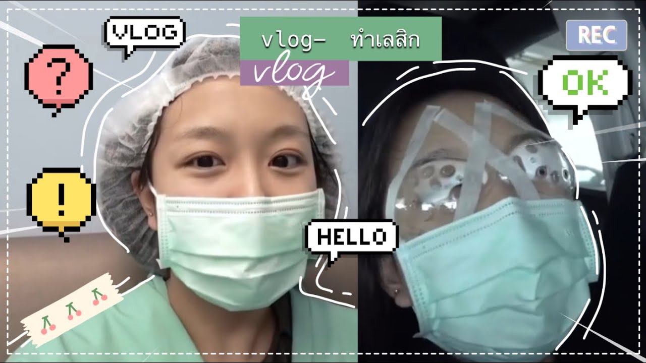 Mewnich&rsquo;s VLOG - ทำเลสิก✨💕🥺