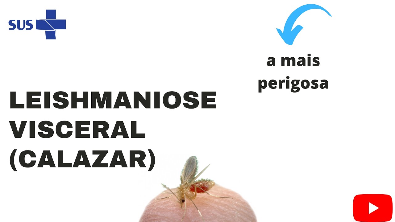 Leishmaniose Visceral (calazar) - características gerais, sintomas e prevenção.