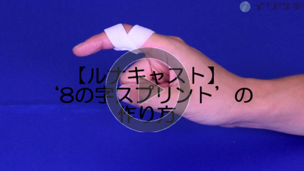 「ルナキャスト」８字スプリント作製例動画（イワツキ株式会社）