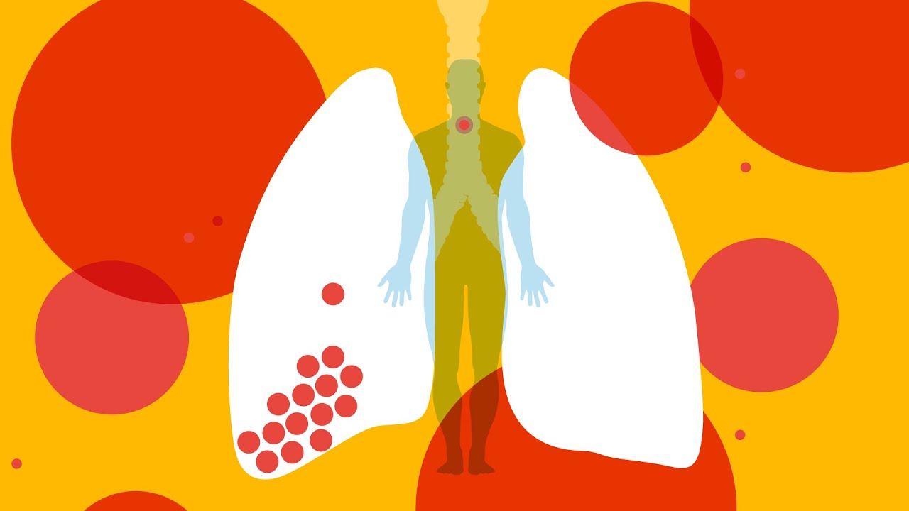 What happens to your body when you get coronavirus