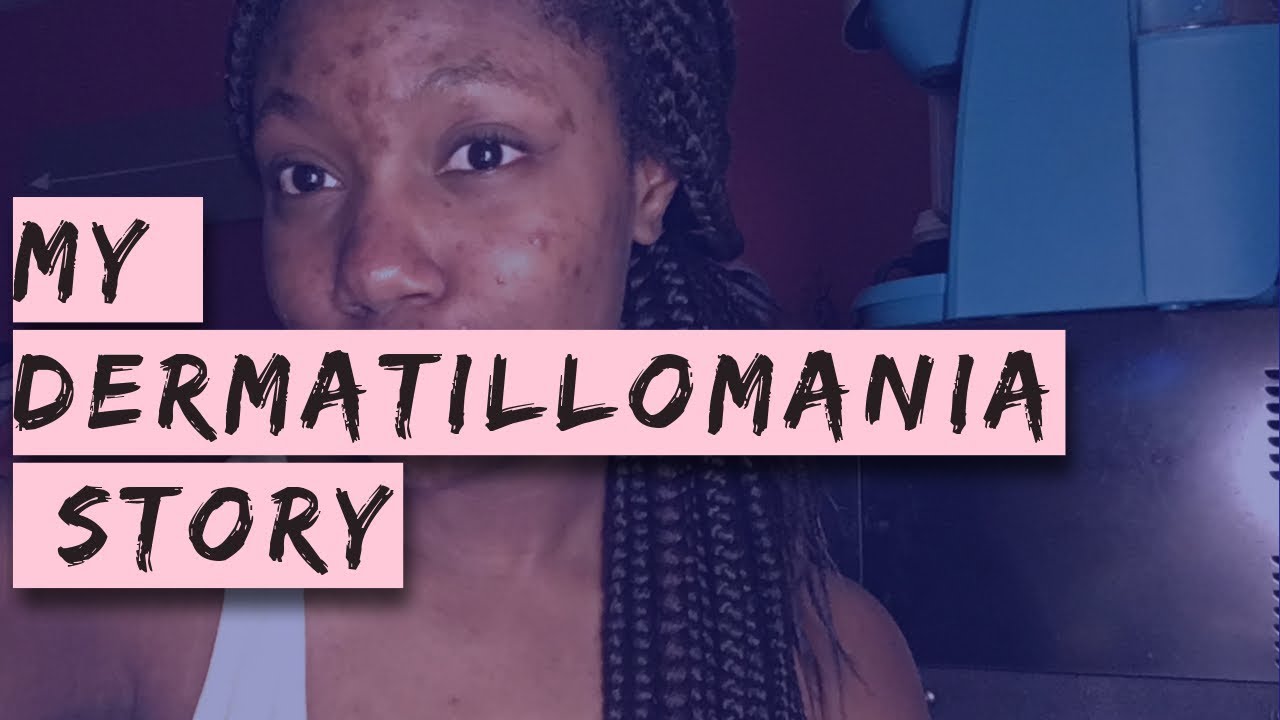 My Dermatillomania (Skin-Picking/Excoriation) Disorder | Acne Scars Uncovered