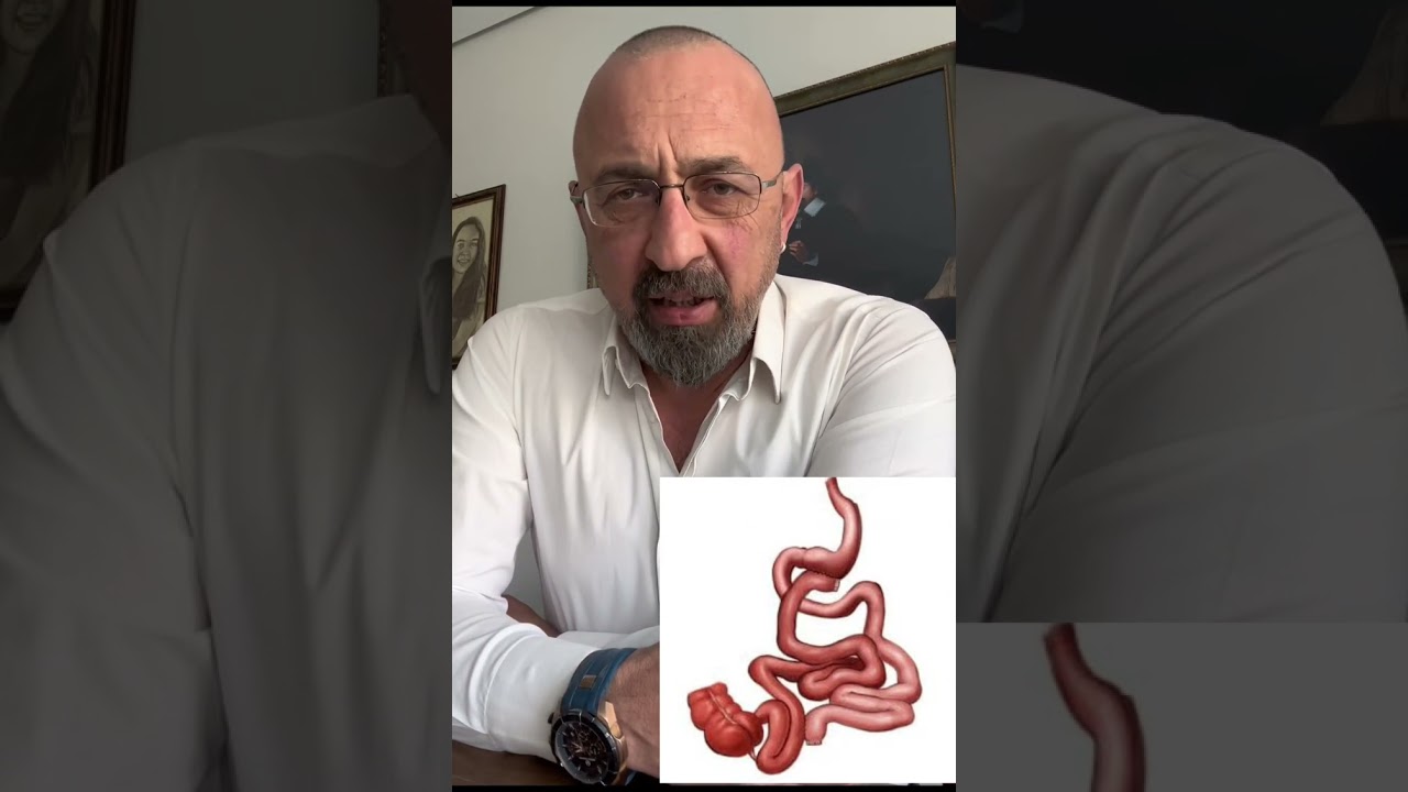 Hangi obezite ameliyatında ne yapıyoruz? Obezite cerrahisi, bariatrik cerrahi, metabolik cerrahi