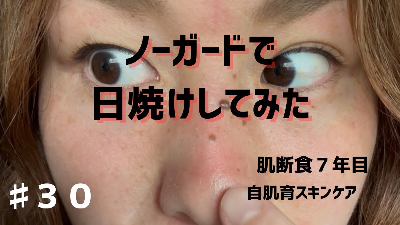 【日焼け】ノーガードで日焼けしてみた！#日焼け対策 #紫外線対策 #日焼け #小麦肌 #皮むけ