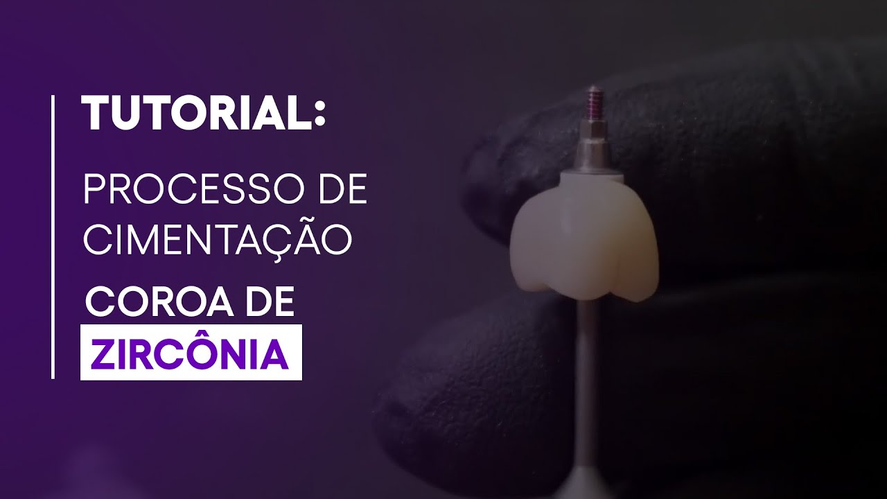 TUTORIAL | CIMENTAÇÃO DA COROA DE ZIRCÔNIA