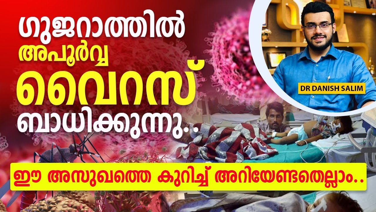 1870: ഗുജറാത്തിൽ പടരുന്ന ചാന്തിപുര വൈറസ്  | എങ്ങനെ ഒഴിവാക്കാം ഈ അസുഖം | CHANDIPURA VIRUS