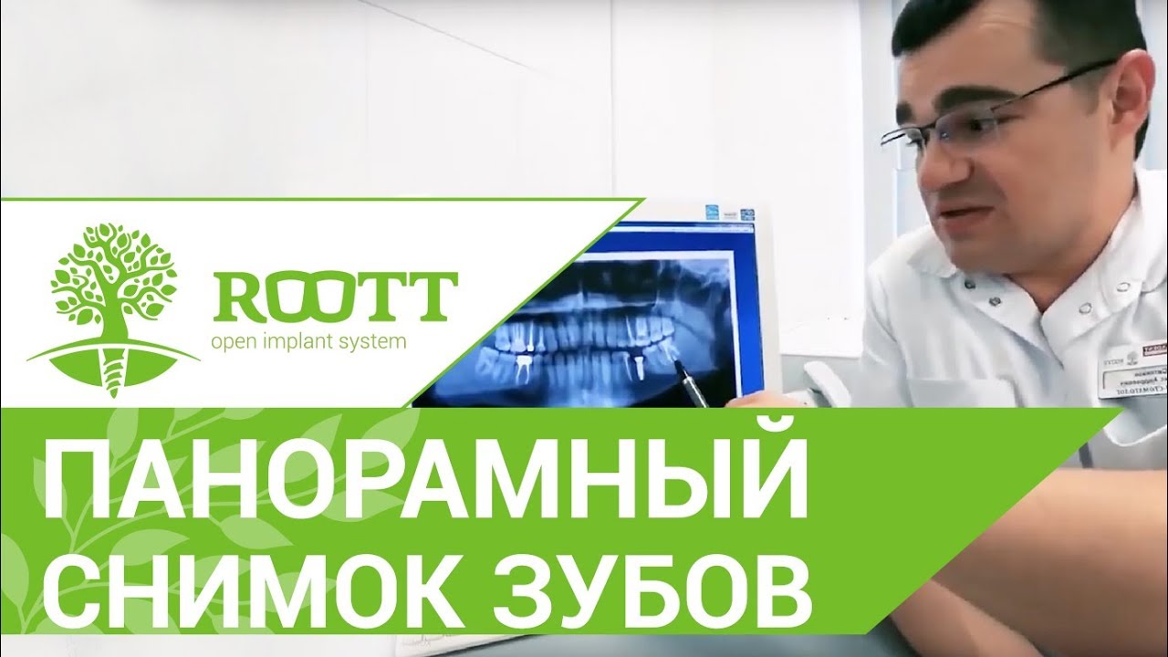 📷  Стоматолог расшифровывает панорамный снимок зубов. Панорамный снимок зубов расшифровка. 12+