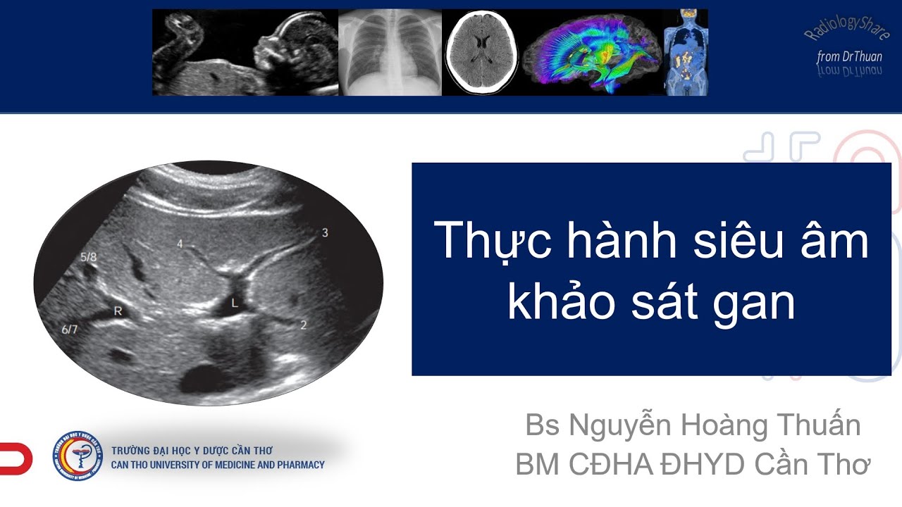 Thực hành siêu âm 2021 khảo sát Gan