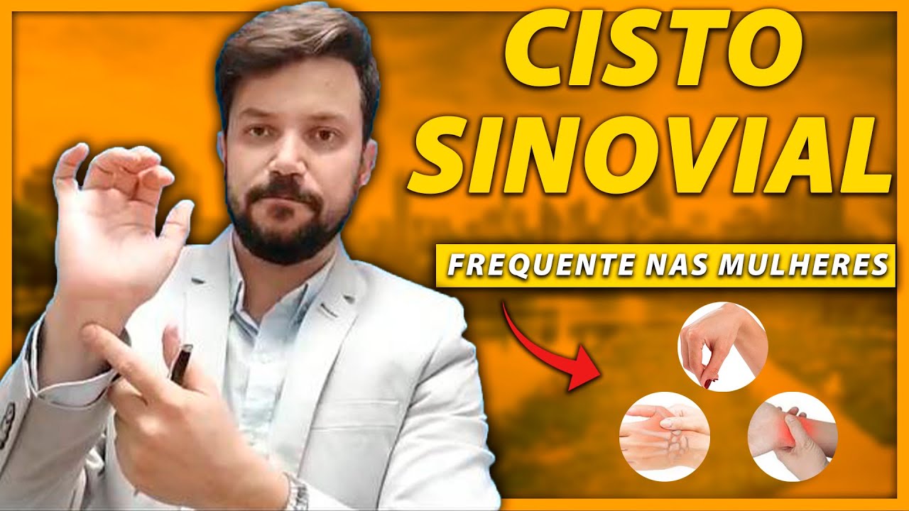 CISTO SINOVIAL | O QUE É?