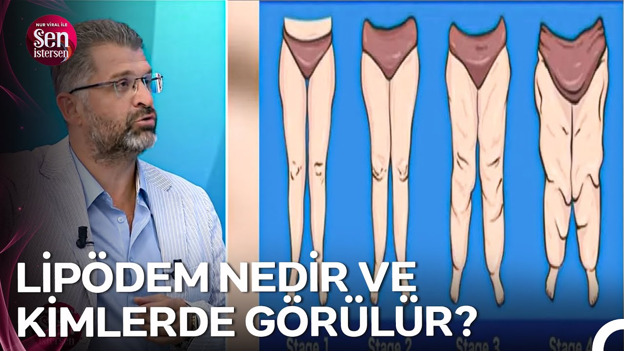Kalp ve Damar Cerrahi Uzm. Asst. Prof. Dr. Orhan Rodoplu Anlatıyor... - Nur Viral ile Sen İstersen