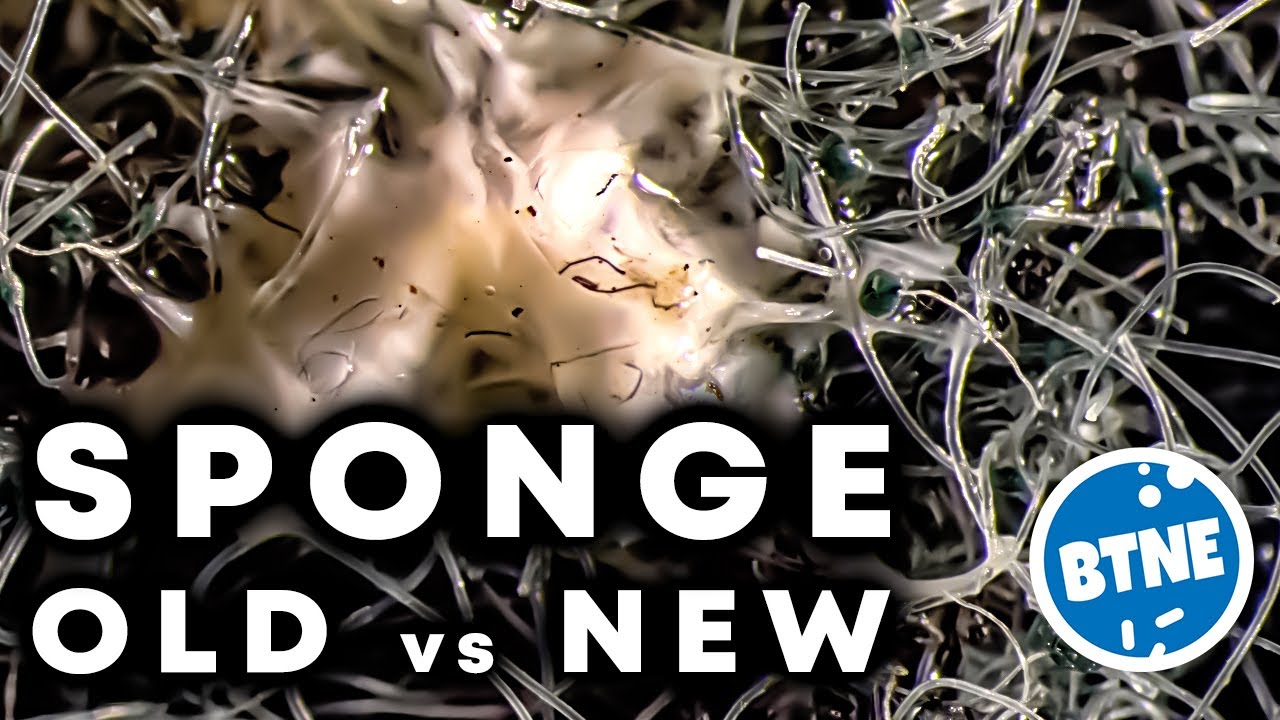 Old Vs New Kitchen Sponge Under The Microscope