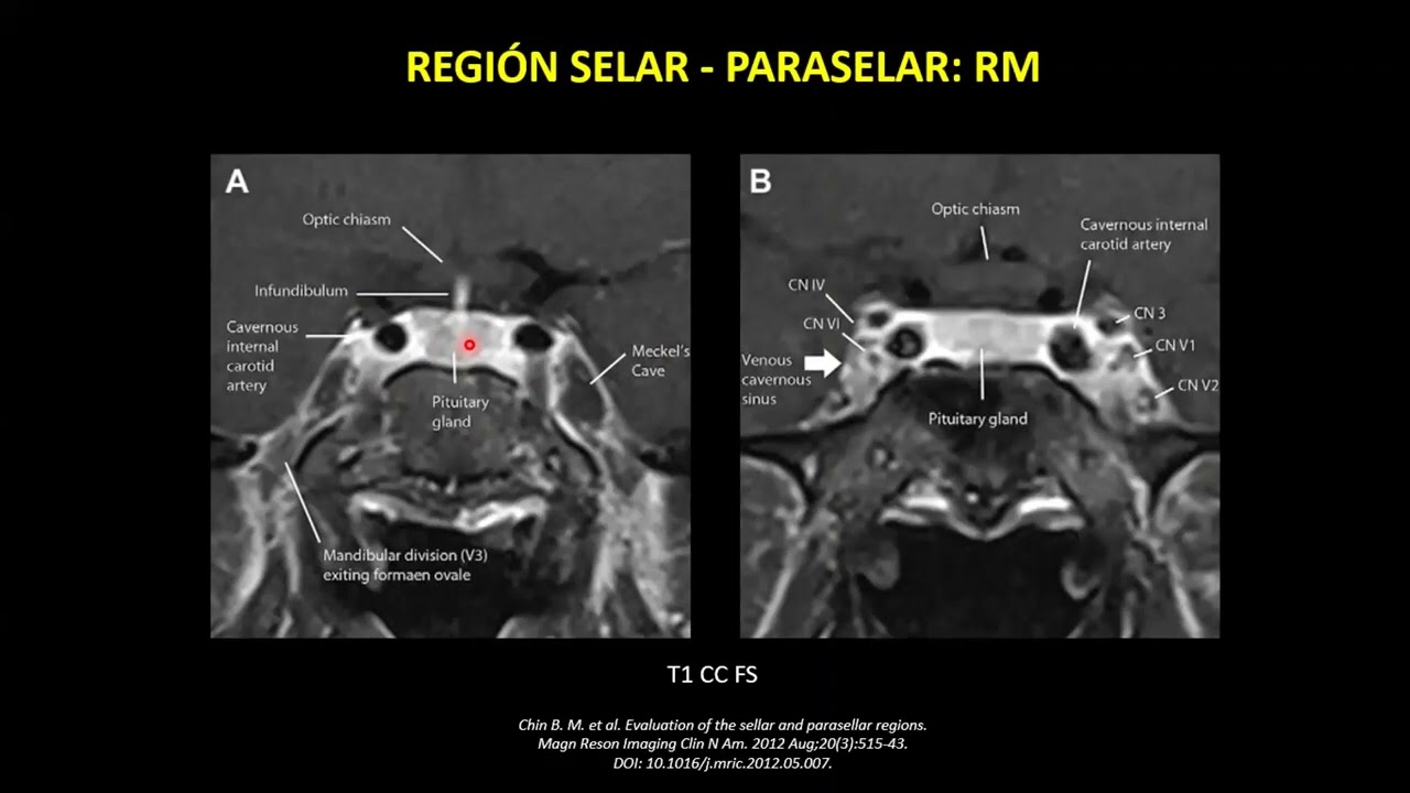 MASAS SELARES Y PARASELARES