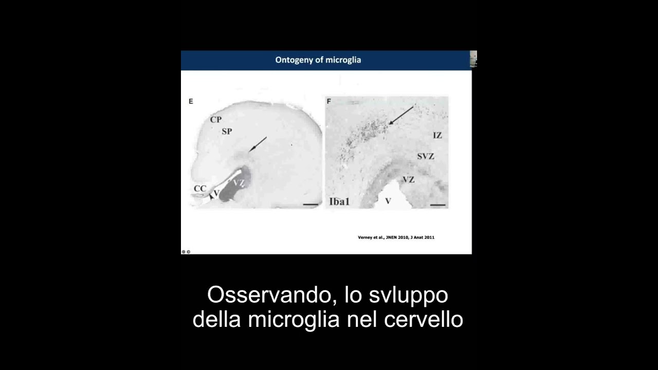 Understanding preterm brain development Pierre Gressens -7 NOV 2023 - IT SUBS