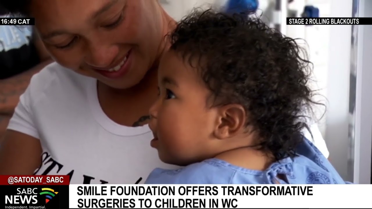Smile foundation offers transformative surgeries to children in Western Cape