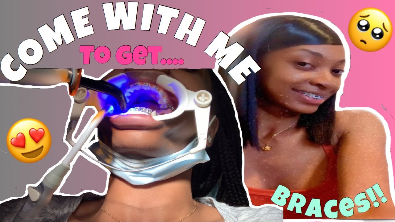 COME WITH ME TO GET BRACES + Spacers!! | Vlog | Did they hurt?!?