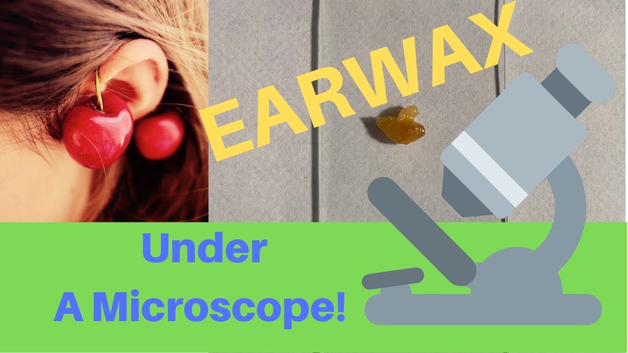 GIANT Earwax Ball Under A Microscope!