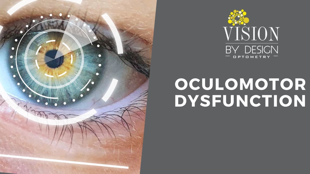 Vision Therapy Edmonton | Oculomotor Dysfunction