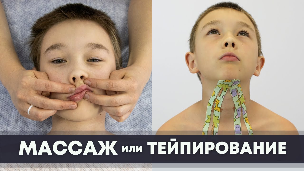 Как сочетать тейпирование и массаж? Логопедический массаж