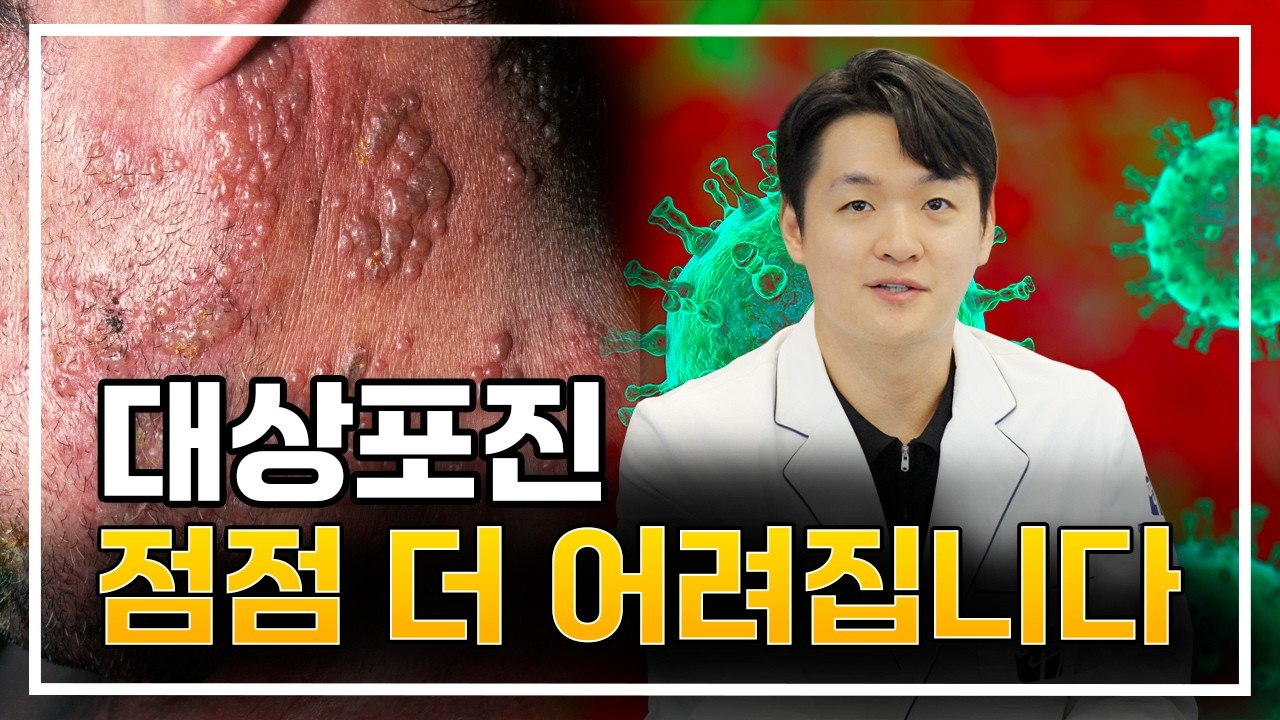 죽음보다 더한 고통, 대상포진 원인부터 초기 치료, 후유증까지 | 대상포진의 모든것을 알려드립니다.