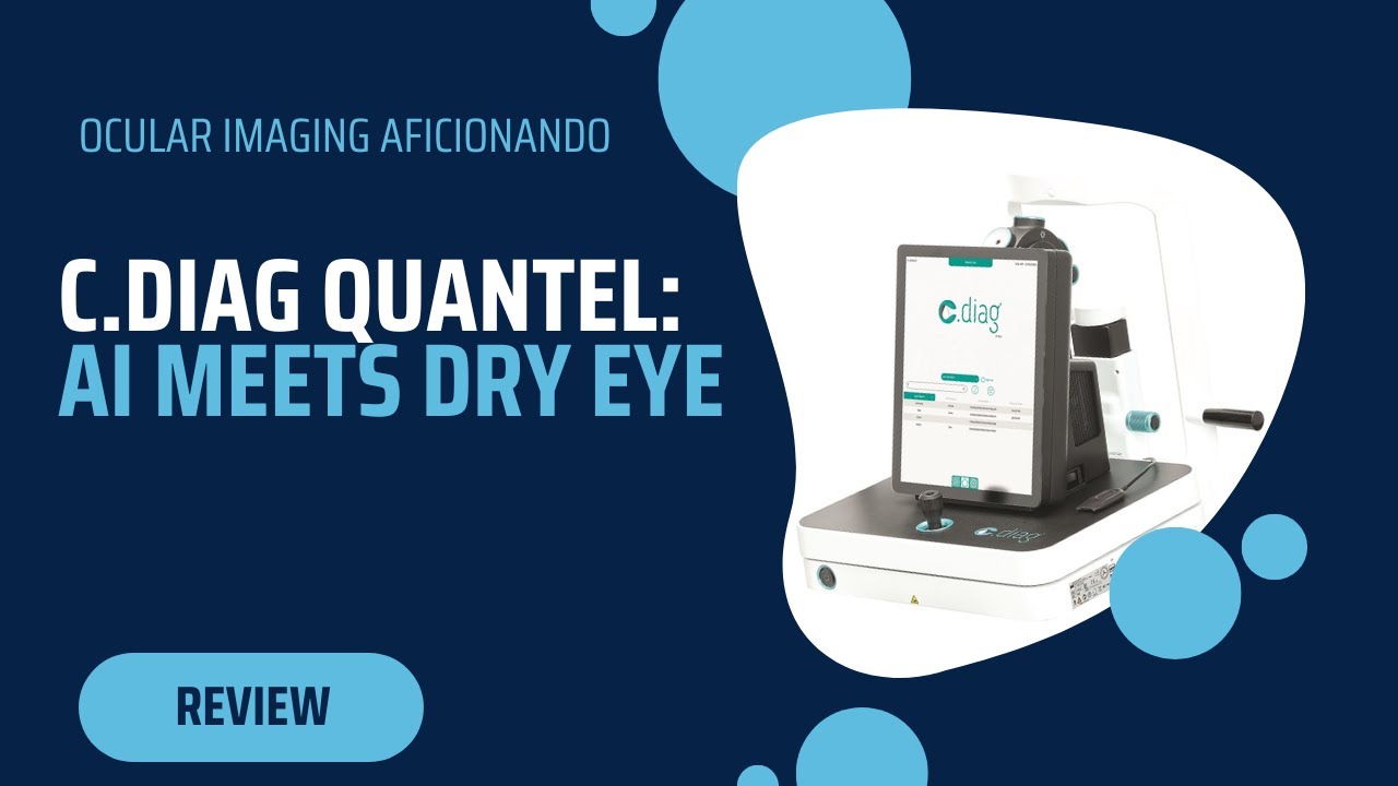 AI Meets Dry Eye. A review of C.DIAG