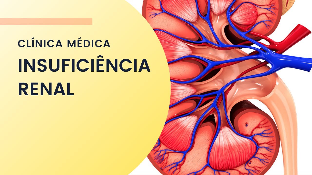 Insuficiência Renal aguda e crônica
