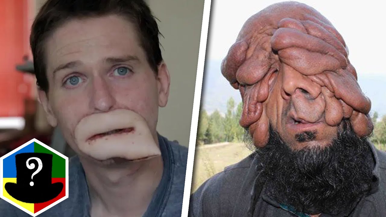 TOP 10 Specielle Mennesker!