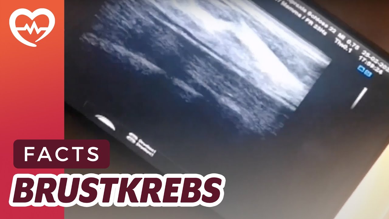 Ein nachdenklicher Diagnosen-Dienstag: Brustkrebs