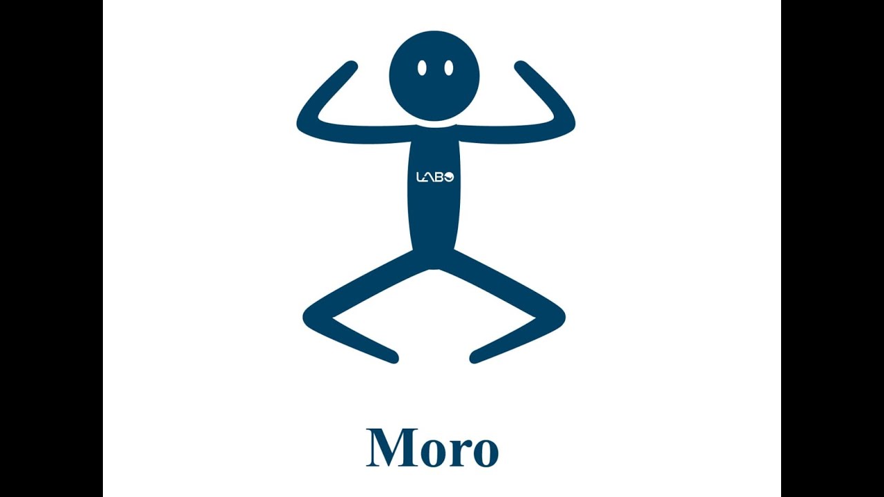 Réflexe de MORO - Test