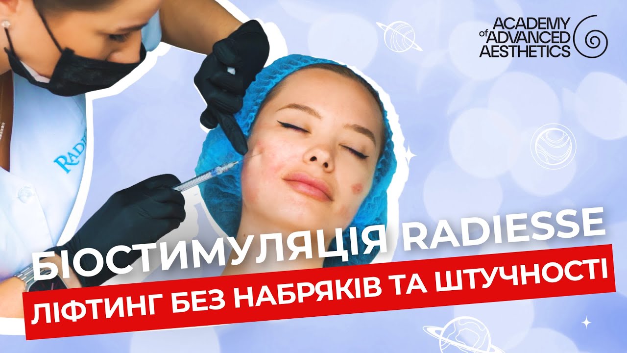 Біостимуляція Radiesse. Ліфтинг без набряків та штучності