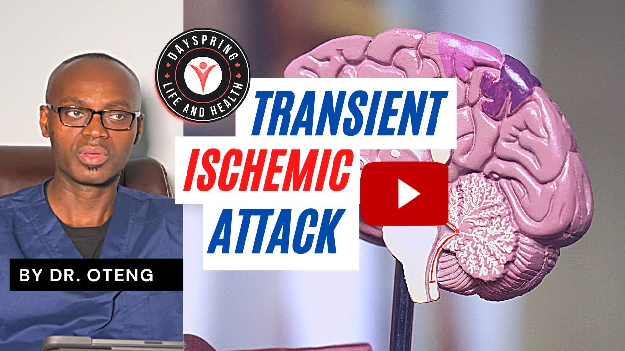 What Is A Transient Ischemic Attack? #tia