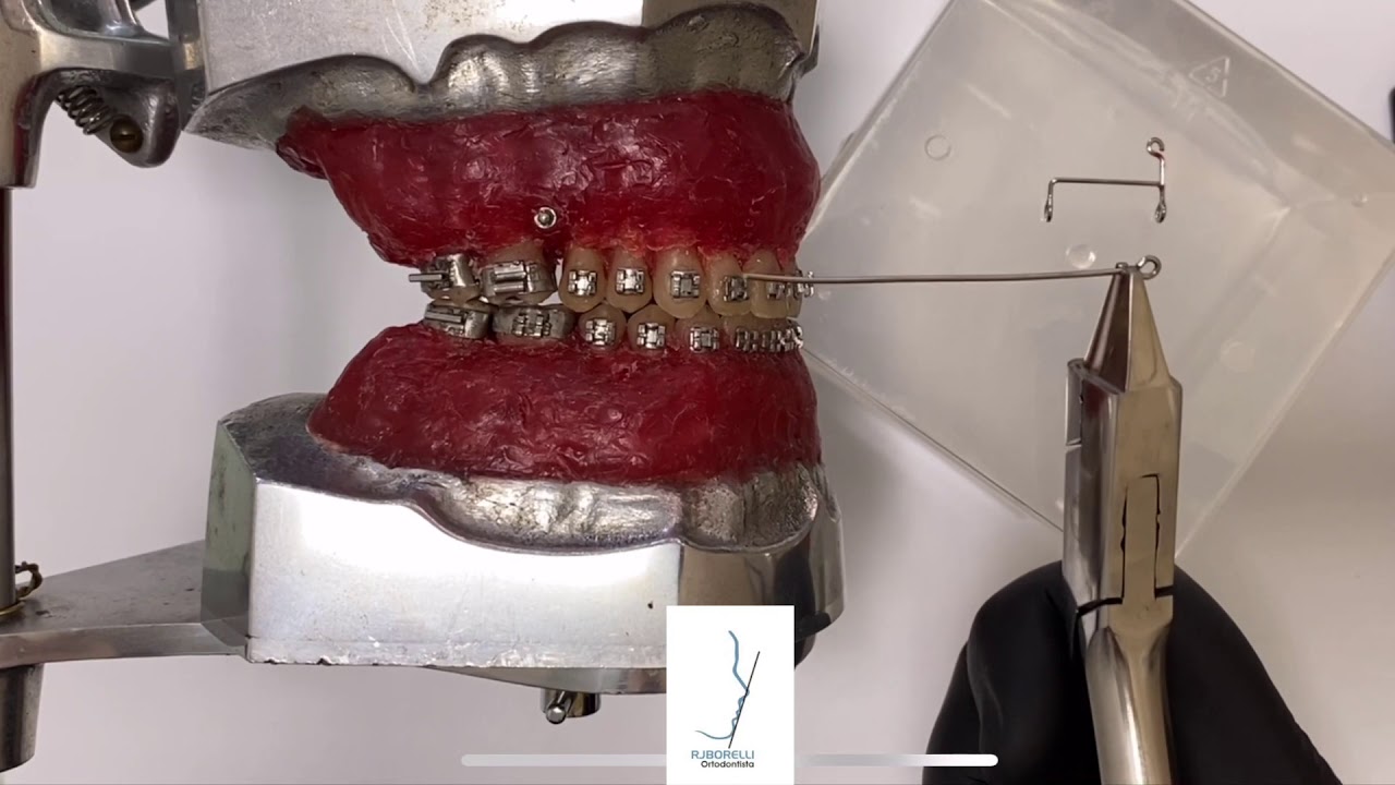 Cursor para Mini-Implantes