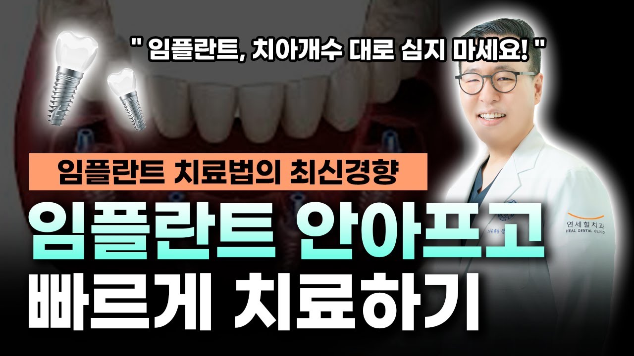 임플란트 과정부터 실제 사례까지 총정리 | 임플란트 치료법의 최신경향