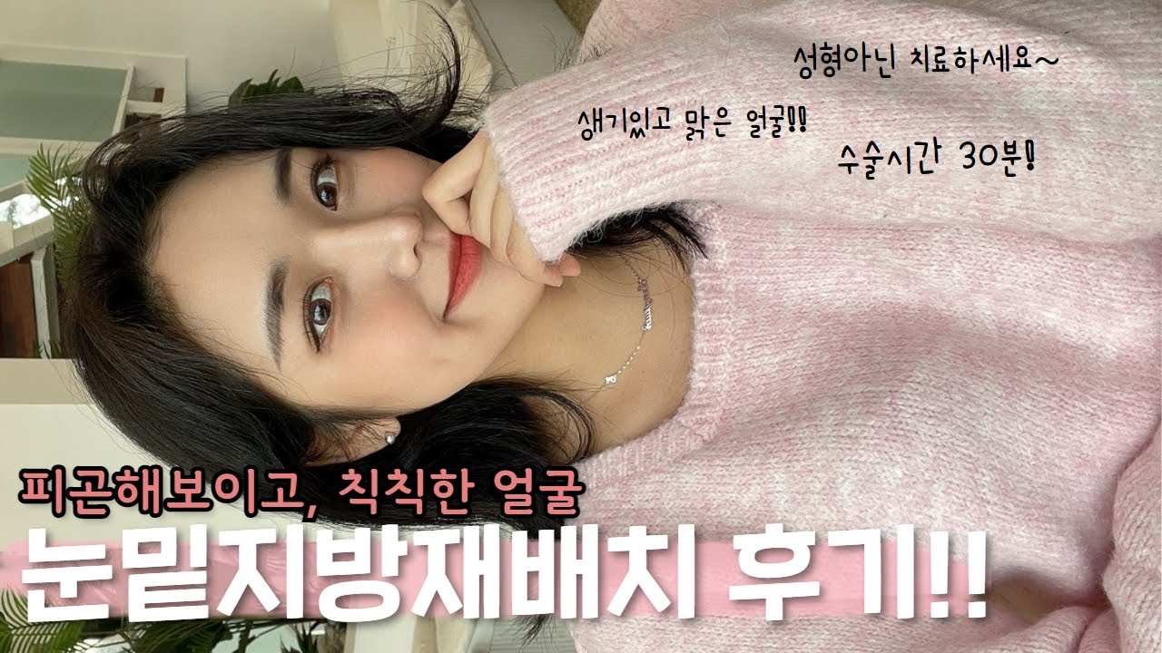 붓기 전혀 없는 눈밑지방재배치??! 친구들이 갑자기 이뻐졌데용🎀  수술1일차~7일차! #눈밑지방재배치