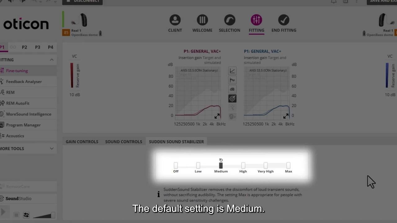 Fitting Oticon Real with SuddenSound Stabilizer