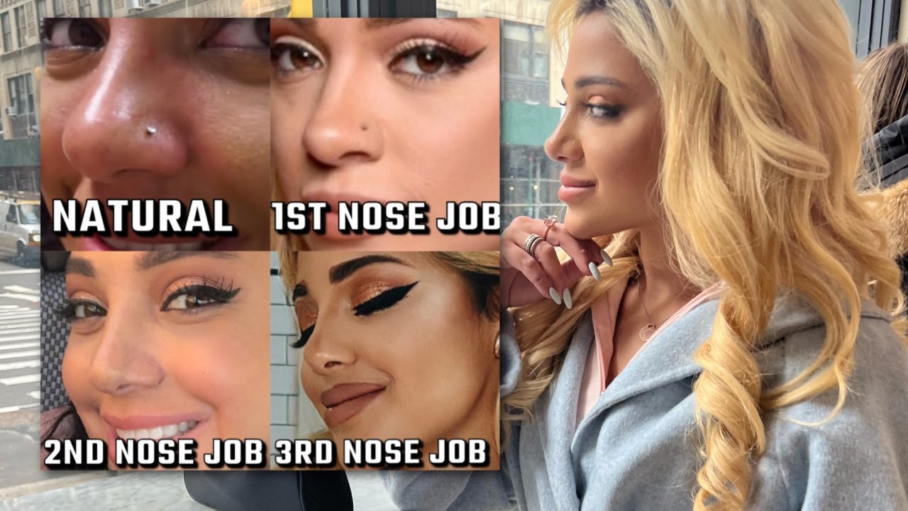 nose job #3 (footage + experience) - gabi demartino