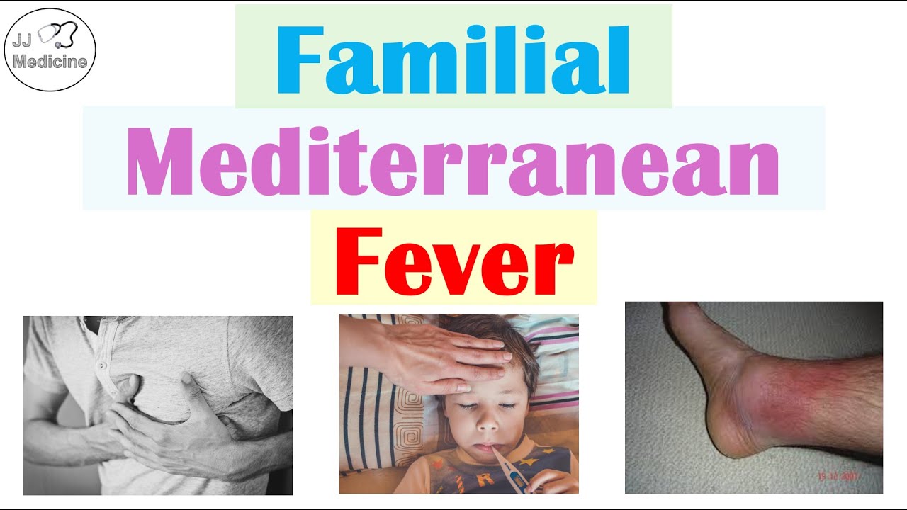 Familial Mediterranean Fever | Pathophysiology, Symptoms, Diagnosis, Treatment