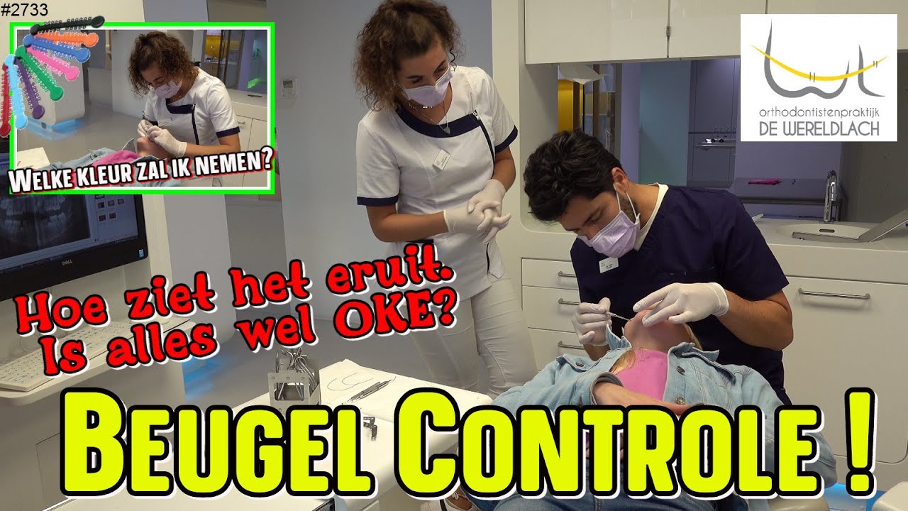 SLOTJESBEUGEL Controle bij de ORTHODONTIST. NIEUWE KLEUR ELASTIEKJES. GEEN BUITENBOORDBEUGEL? #2733