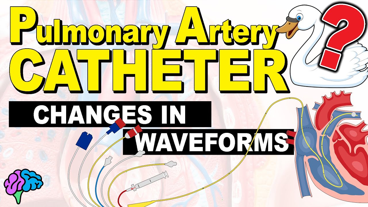 Changes to our PA Catheter Waveforms and Values!