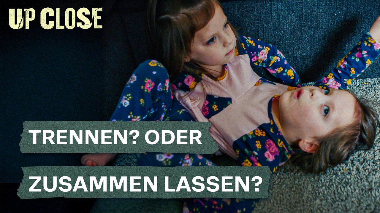 Werden diese Eltern ihre siamesischen Zwillinge wirklich trennen? | Teil 2