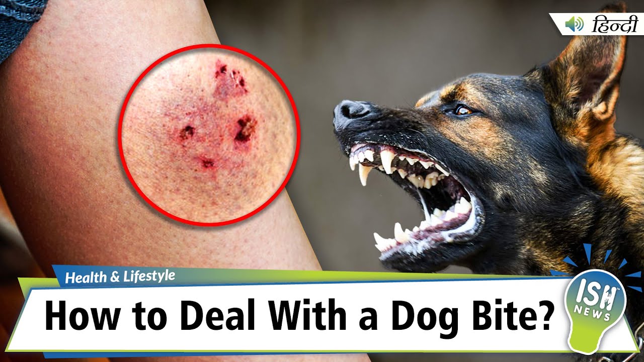 How to Deal With a Dog Bite? | ISH News