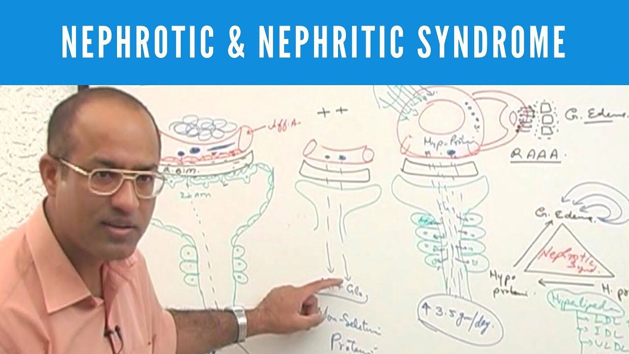 Nephrotic and Nephritic Syndrome | Causes Symptoms & Treatment🩺