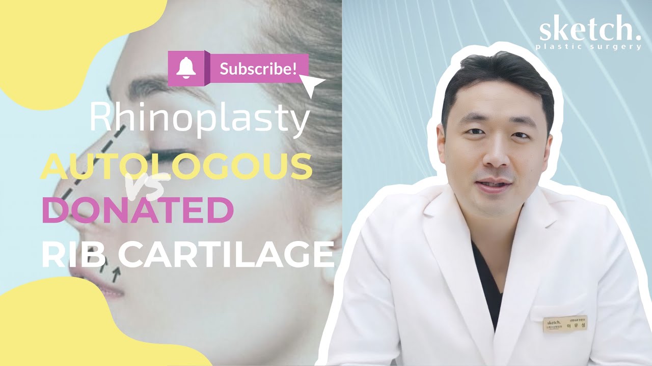 Rhinoplasty MaterialsㅣAutologous Rib Cartilage VS Donated Rib CartilageㅣWhich one is better?