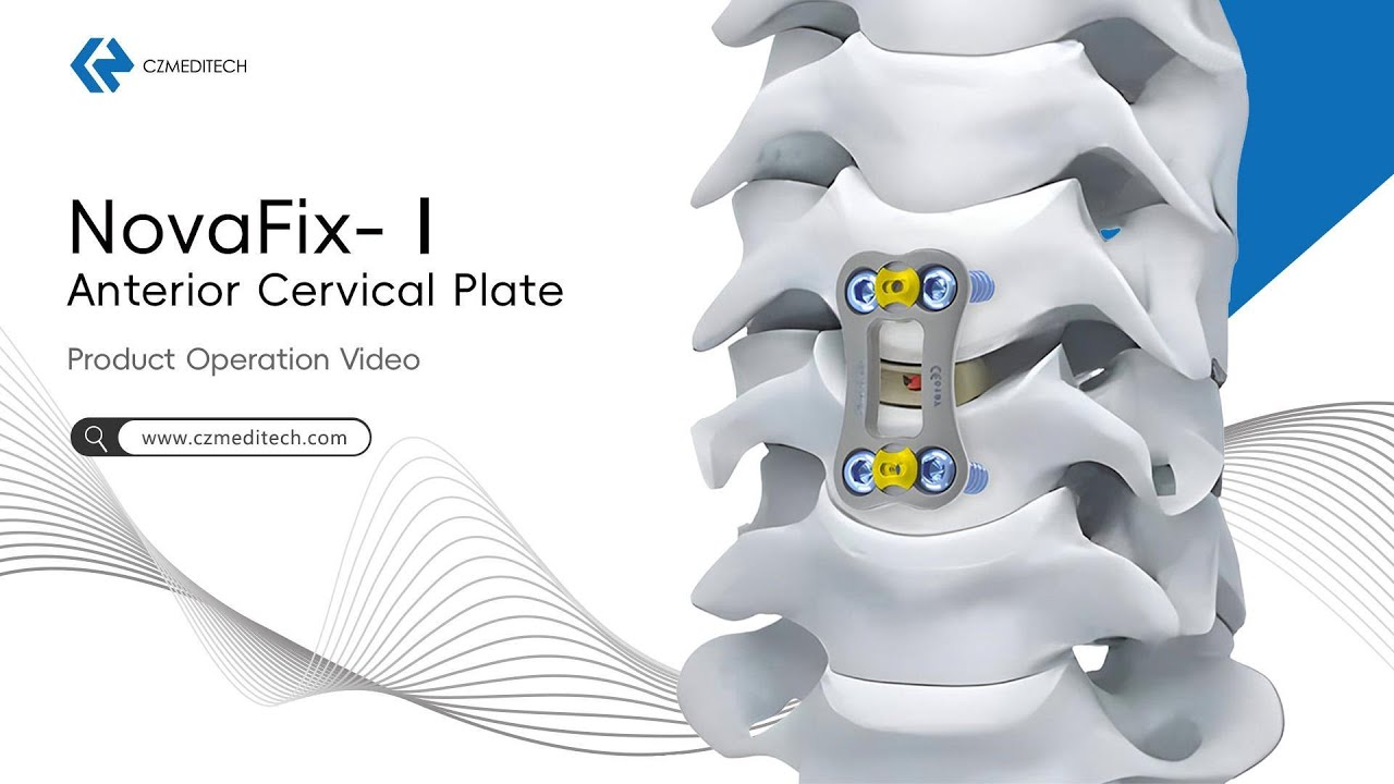 NovaFix-I Anterior Cervical Plate | Surgical Technique & Operation Steps
